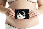 Baby scan